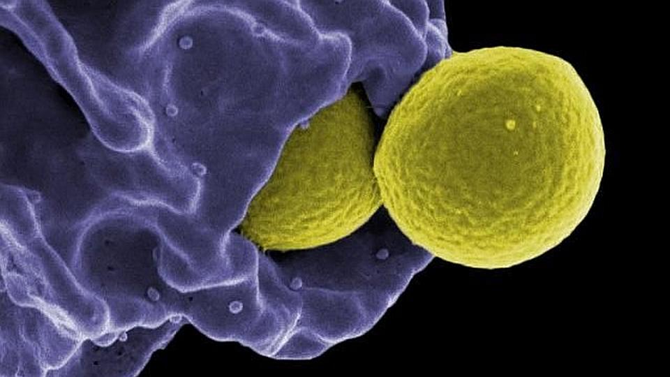 ‘Fortunate Accident’ May Yield Immunity Weapon Against Antibiotic-Resistant Bacteria
